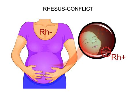 rhd positiv gravid|The Rh Factor: How It Can Affect Your Pregnancy